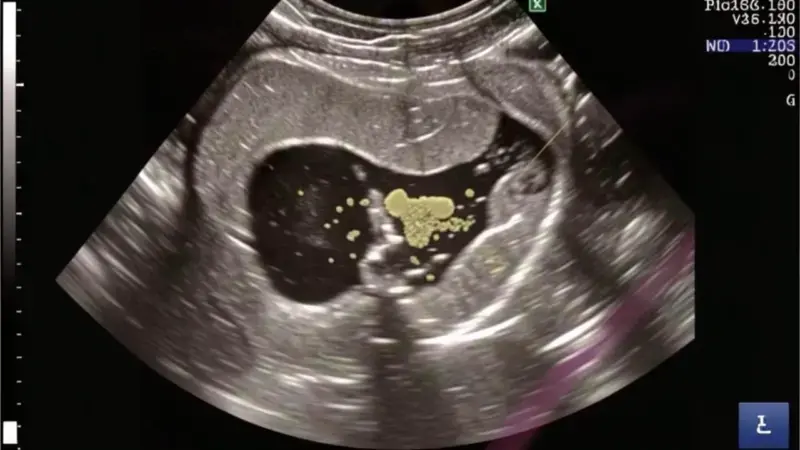 Infección Urinaria en Conejos: Barro, Cistolitos y Cistitis - cuidados veterinarios para pequeños mamíferos