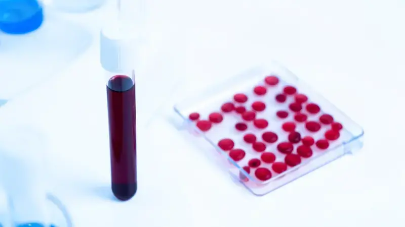 Muestra de sangre felina en tubo de análisis junto a portaobjetos con eritrocitos - micoplasmosis felina anemia